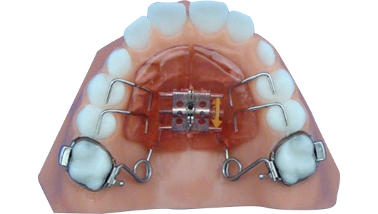 Expander