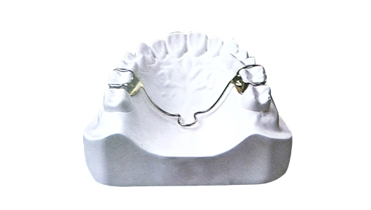 Trans Palatal Arch