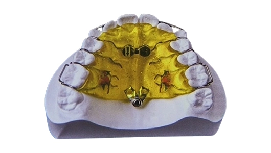 Fan-Type Expander