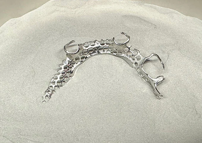 Analysis of the Global Market Application of Dental Alloy Materials