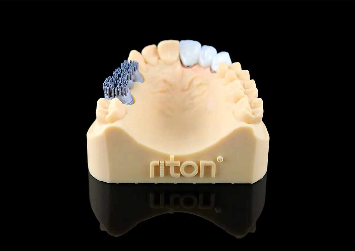 Dental Crown-01 (CoCr)
