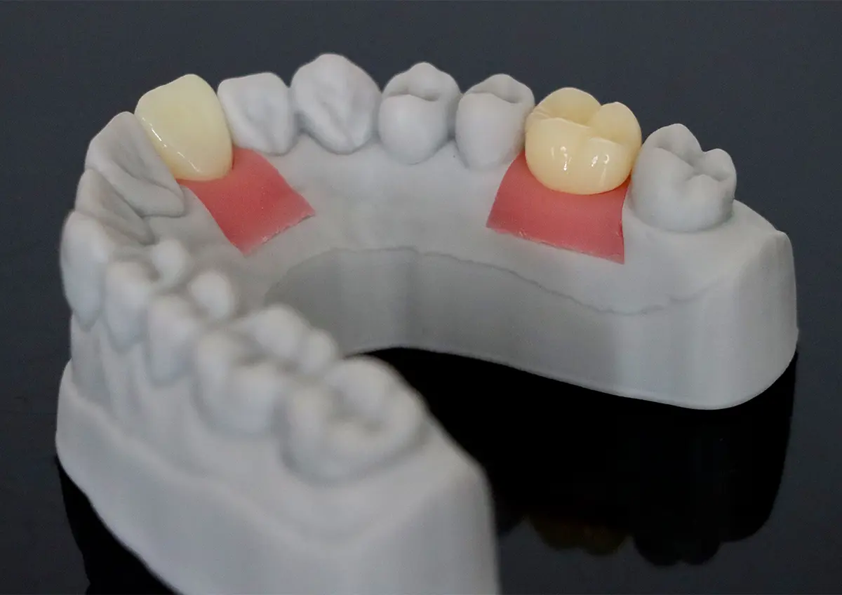Flexible Gum Simulation For Dental Model-03