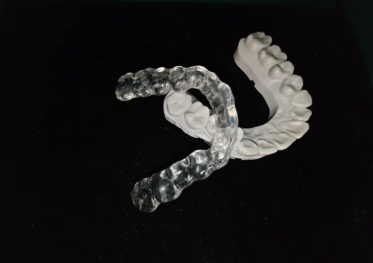 Try-in Denture