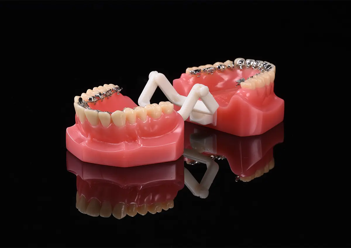 Lingual Appliance (CoCr)