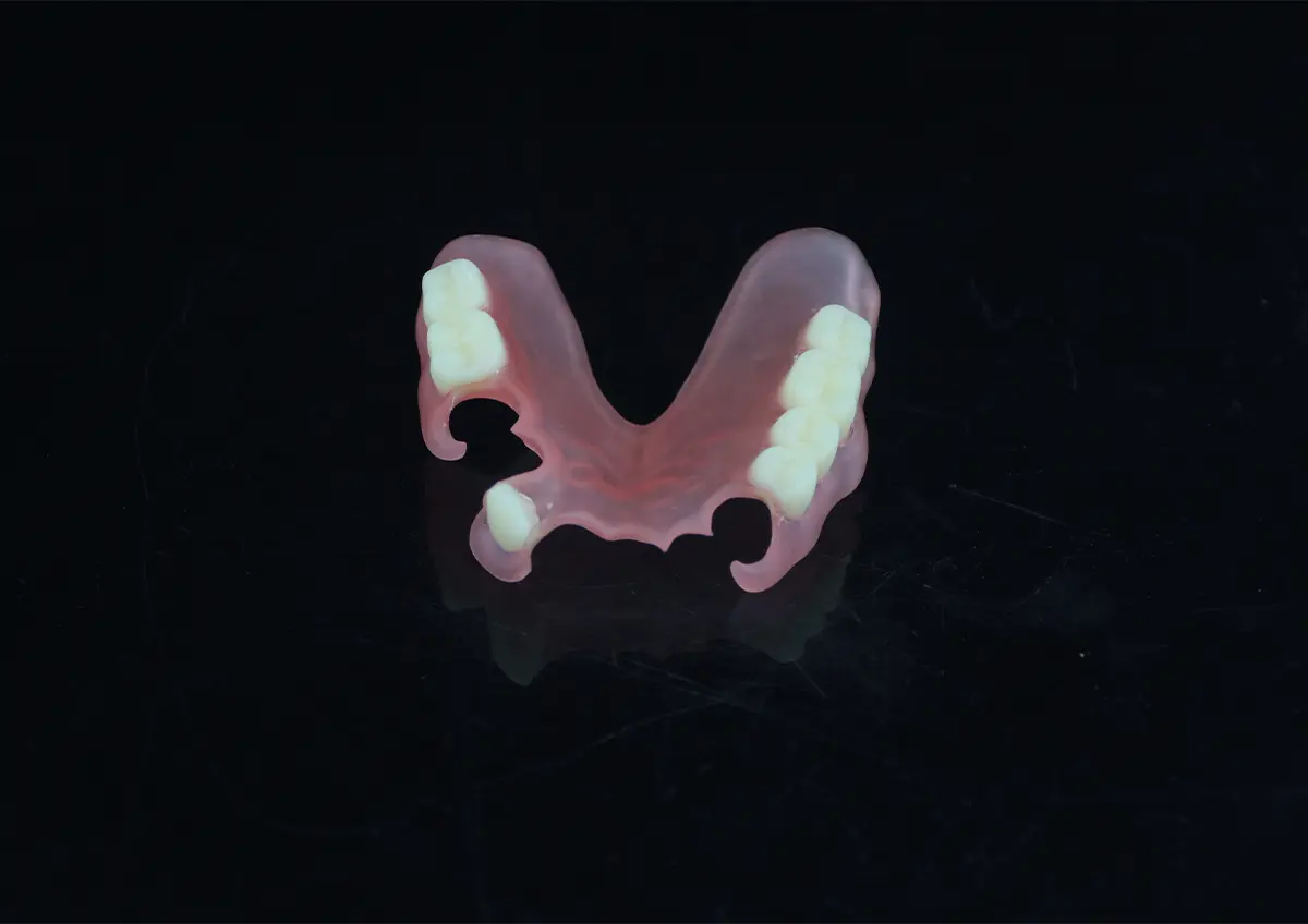 Removable Partial Denture
