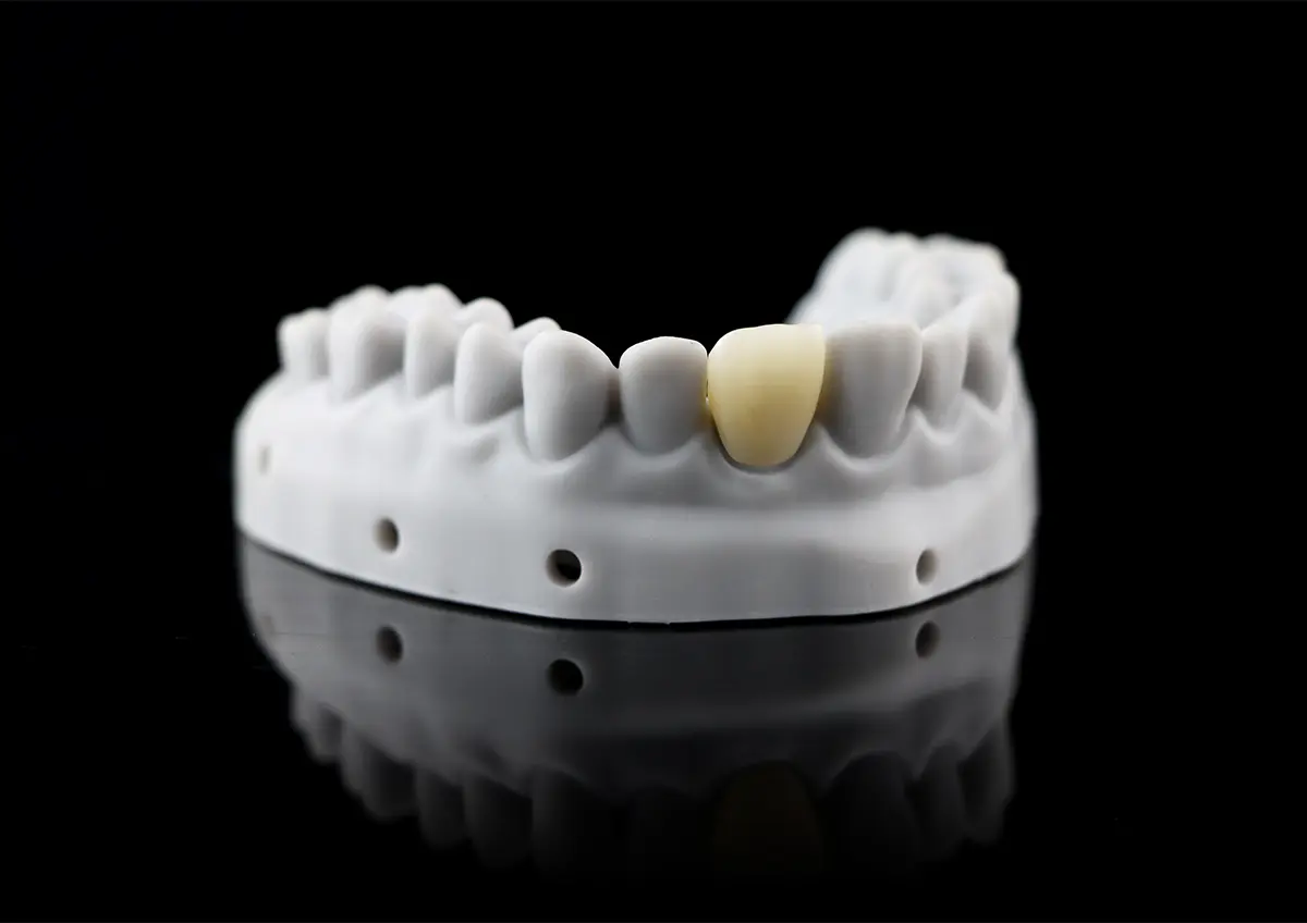 Temporary Crown, Temporary Anterior & Posterior Tooth Restoration