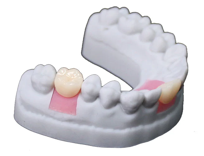 gingiva-mask-resin-model-g-series-sample-display