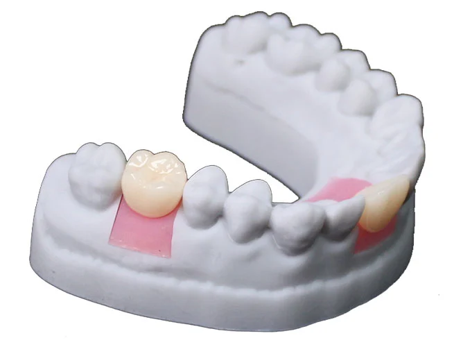 temporary-dental-resin-model-t-series-sample-display