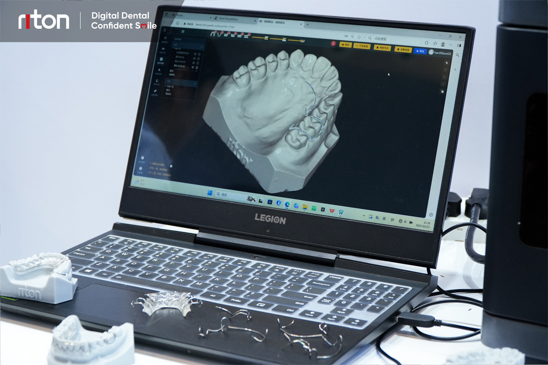 Riton OrthoWireLab Software
