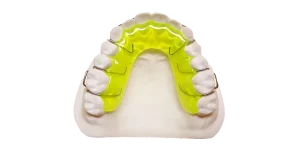 Hawley Retainer
