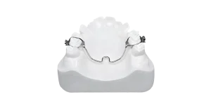 Transpalatal Expander TPA