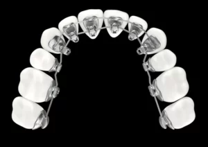 Orthodontic Components